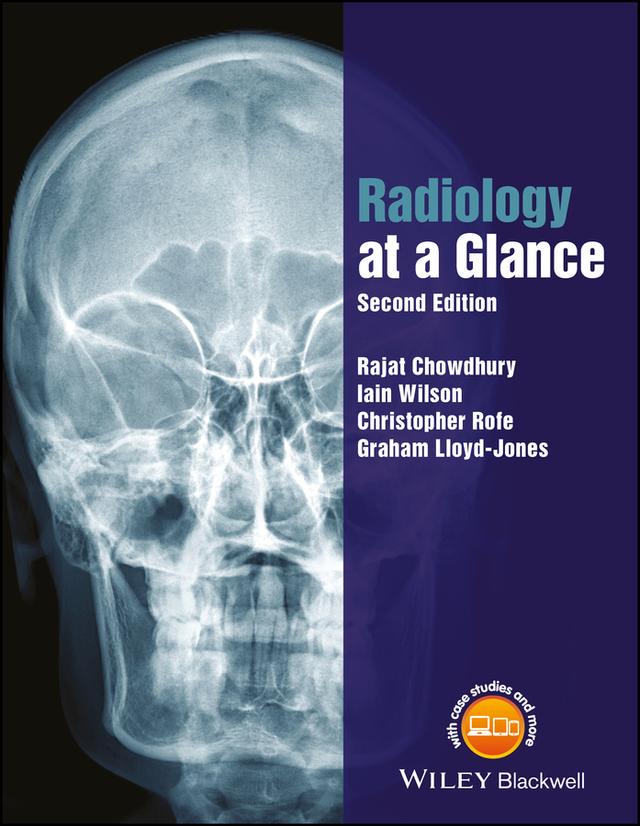 Radiology at a Glance by Christopher Rofe, Graham Lloyd-Jones, Iain Wilson, Rajat Chowdhury