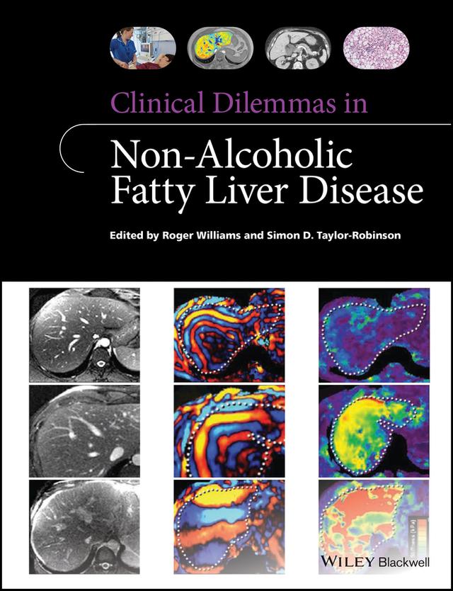 Clinical Dilemmas in Non-Alcoholic Fatty Liver Disease by Roger Williams, Simon D. Taylor-Robinson