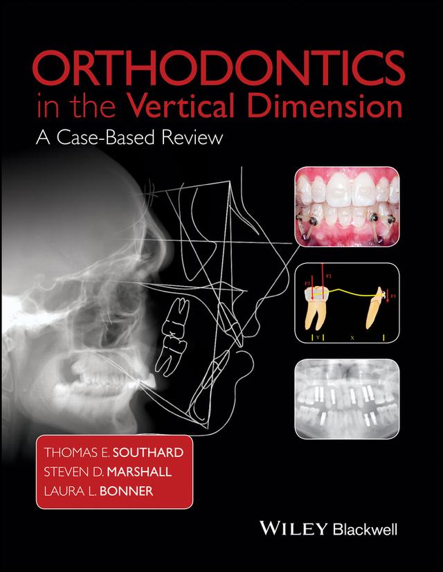 Orthodontics in the Vertical Dimension by Laura L. Bonner, Steven D. Marshall, Thomas E. Southard
