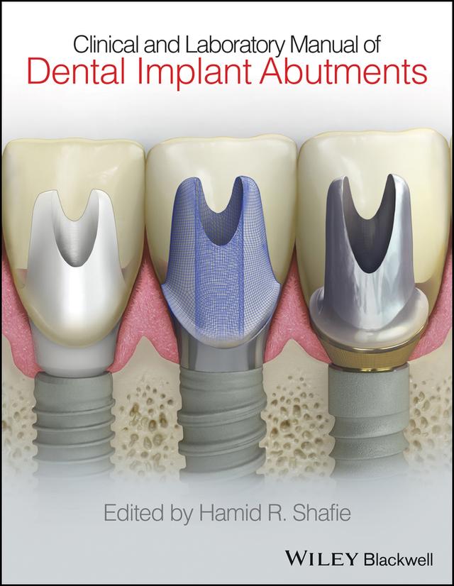 Clinical and Laboratory Manual of Dental Implant Abutments by Hamid R. Shafie