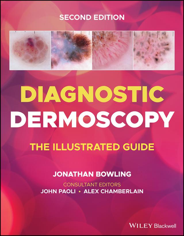 Diagnostic Dermoscopy by Alex Chamberlain, John Paoli, Jonathan Bowling