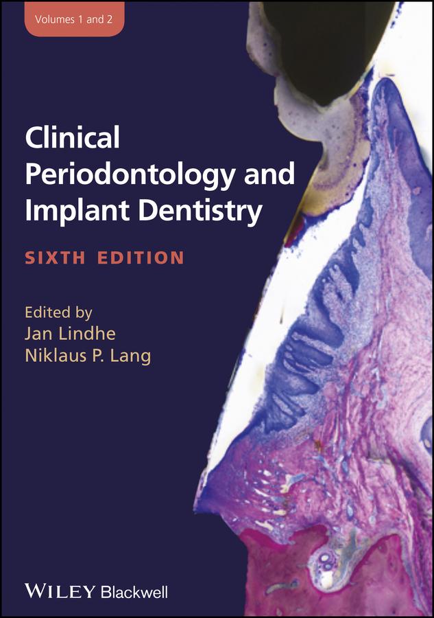 Clinical Periodontology and Implant Dentistry, 2 Volume Set by Jan Lindhe, Niklaus P. Lang
