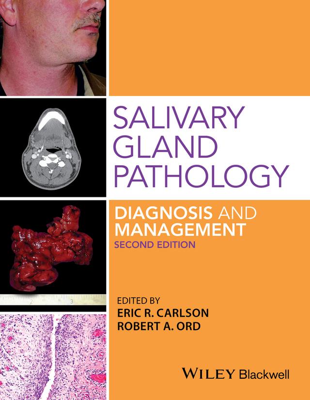 Salivary Gland Pathology by Eric R. Carlson, Robert A. Ord