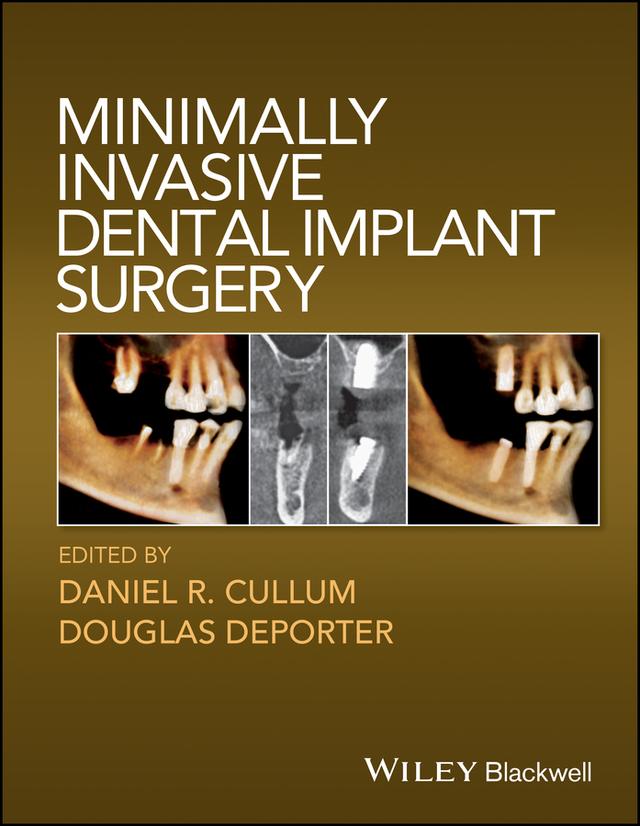 Minimally Invasive Dental Implant Surgery by Daniel R. Cullum, Douglas Deporter