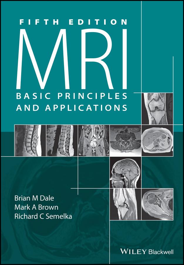 MRI by Brian M. Dale, Mark A. Brown, Richard C. Semelka