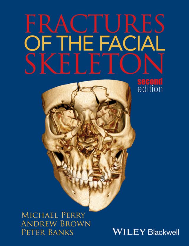 Fractures of the Facial Skeleton by Andrew Brown, Michael Perry, Peter Banks