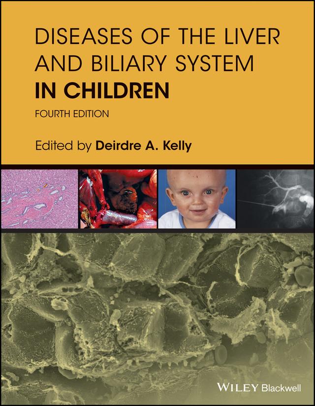 Diseases of the Liver and Biliary System in Children by Deirdre A. Kelly