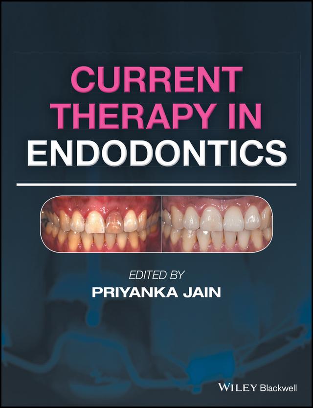 Current Therapy in Endodontics by Priyanka Jain