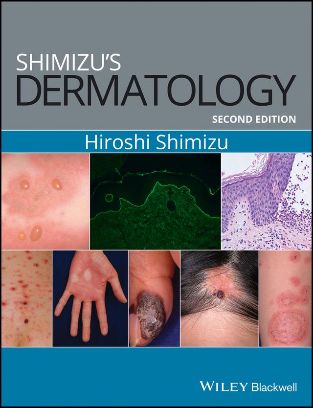 Shimizu's Dermatology by Hiroshi Shimizu
