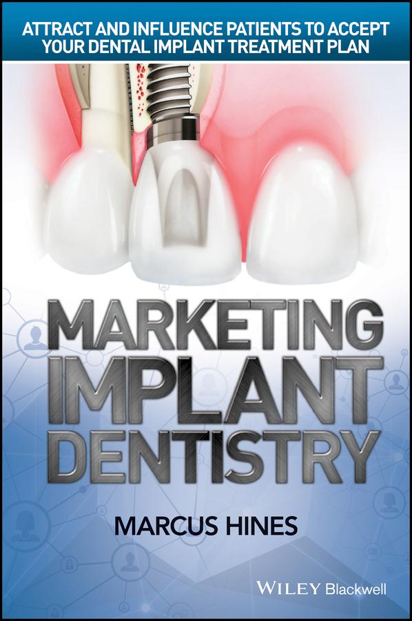Marketing Implant Dentistry by Marcus Hines