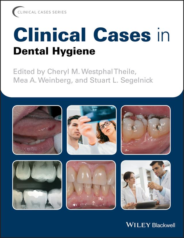Clinical Cases in Dental Hygiene by Cheryl M. Westphal Theile, Mea A. Weinberg, Stuart L. Segelnick