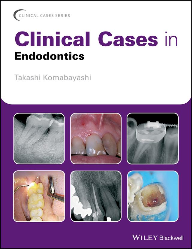 Clinical Cases in Endodontics by Takashi Komabayashi