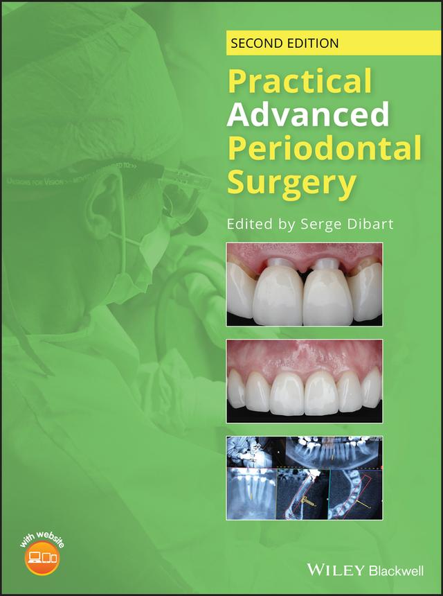 Practical Advanced Periodontal Surgery by Serge Dibart