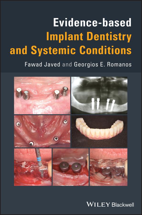 Evidence-based Implant Dentistry and Systemic Conditions by Fawad Javed, Georgios E. Romanos