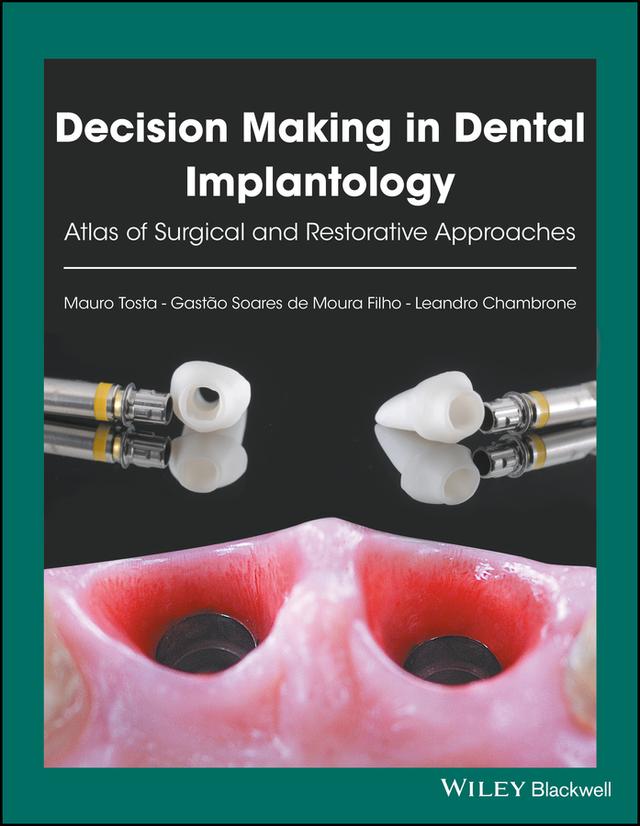 Decision Making in Dental Implantology by Gastão Soares de Moura Filho, Leandro Chambrone, Mauro Tosta