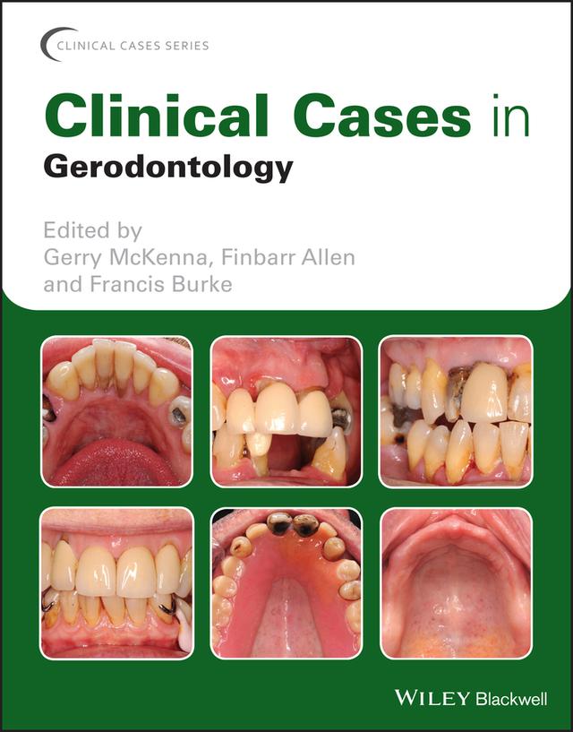 Clinical Cases in Gerodontology by Finbarr Allen, Francis Burke, Gerry McKenna