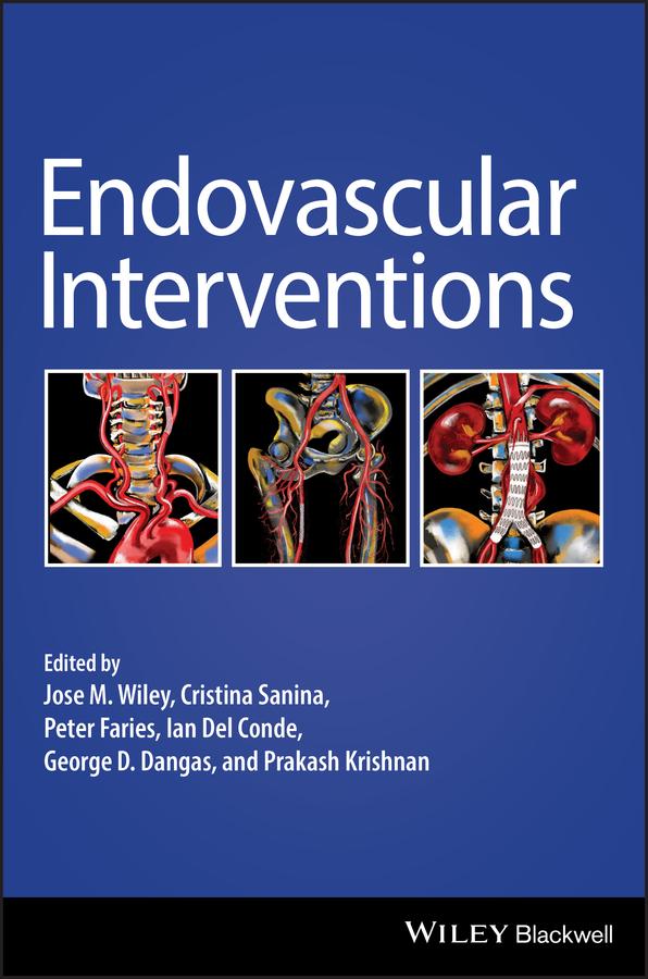Endovascular Interventions by Cristina Sanina, George D. Dangas, Ian Del Conde, Jose M. Wiley, Peter Faries, Prakash Krishnan