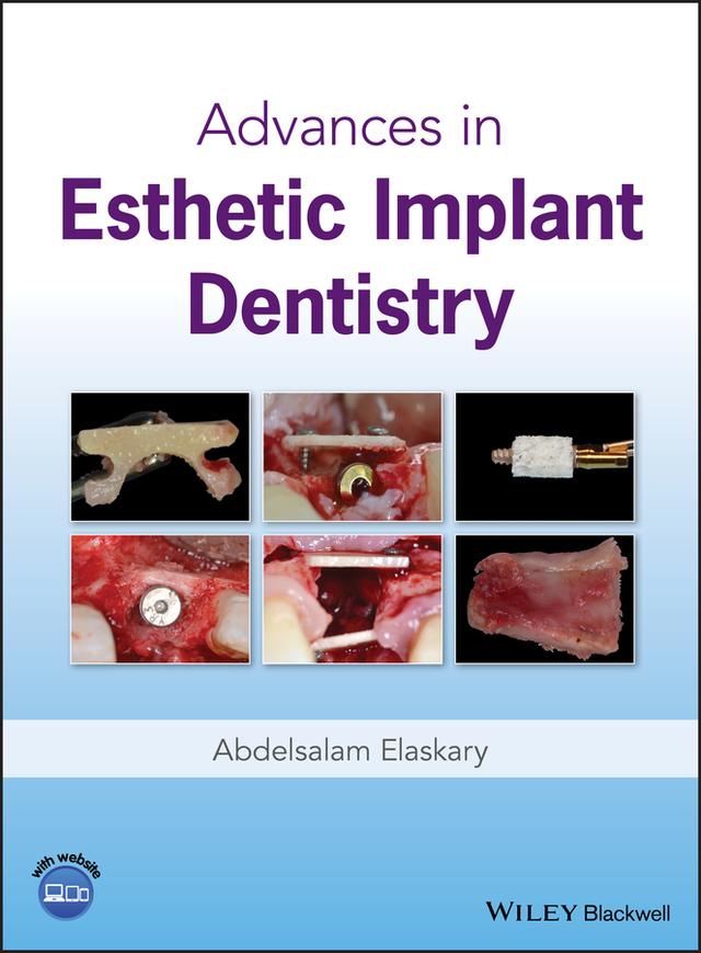 Advances in Esthetic Implant Dentistry by Abdelsalam Elaskary