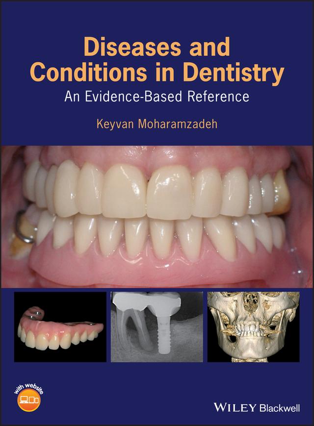 Diseases and Conditions in Dentistry by Keyvan Moharamzadeh