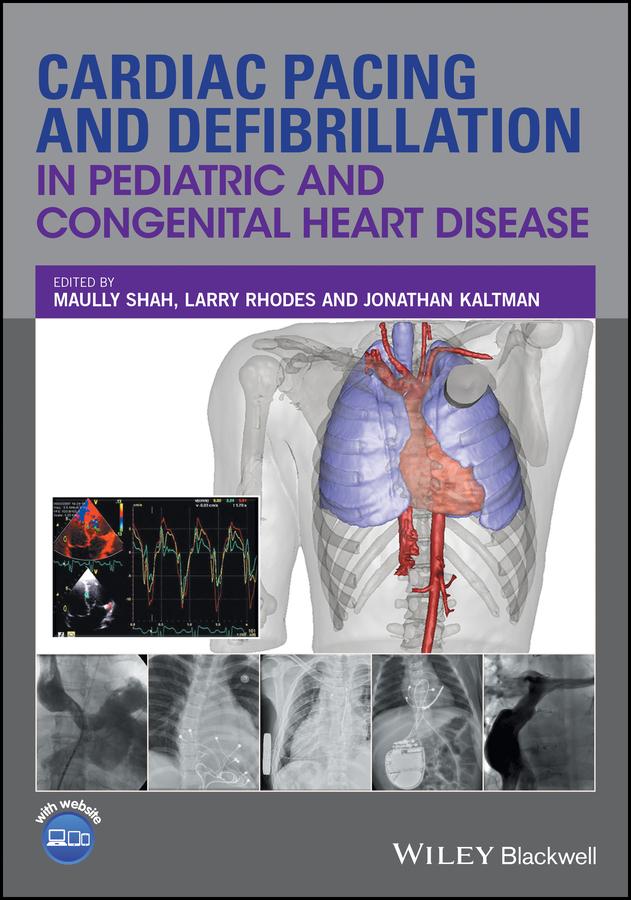 Cardiac Pacing and Defibrillation in Pediatric and Congenital Heart Disease by Jonathan Kaltman, Larry Rhodes, Maully Shah