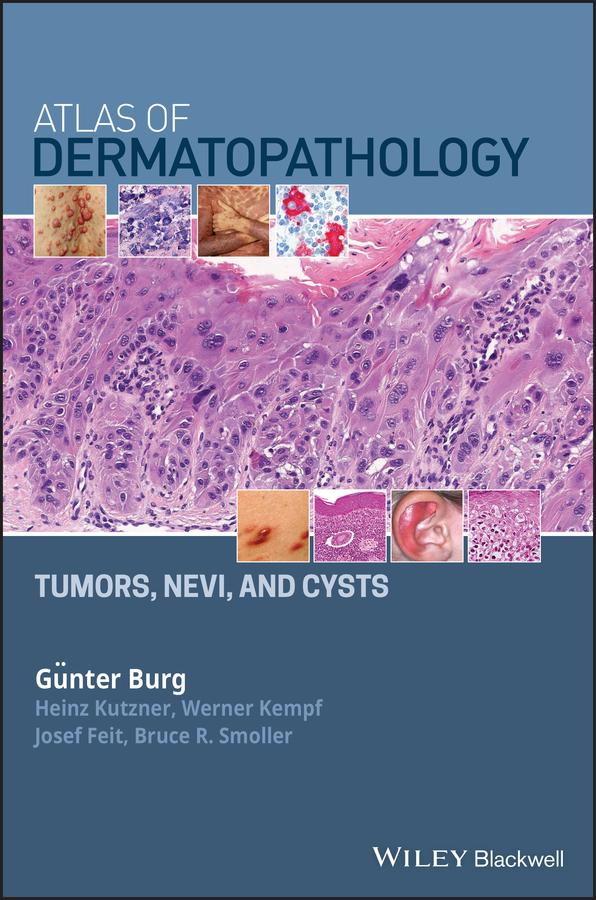 Atlas of Dermatopathology by Bruce R. Smoller, Günter Burg, Heinz Kutzner, Josef Feit, Werner Kempf