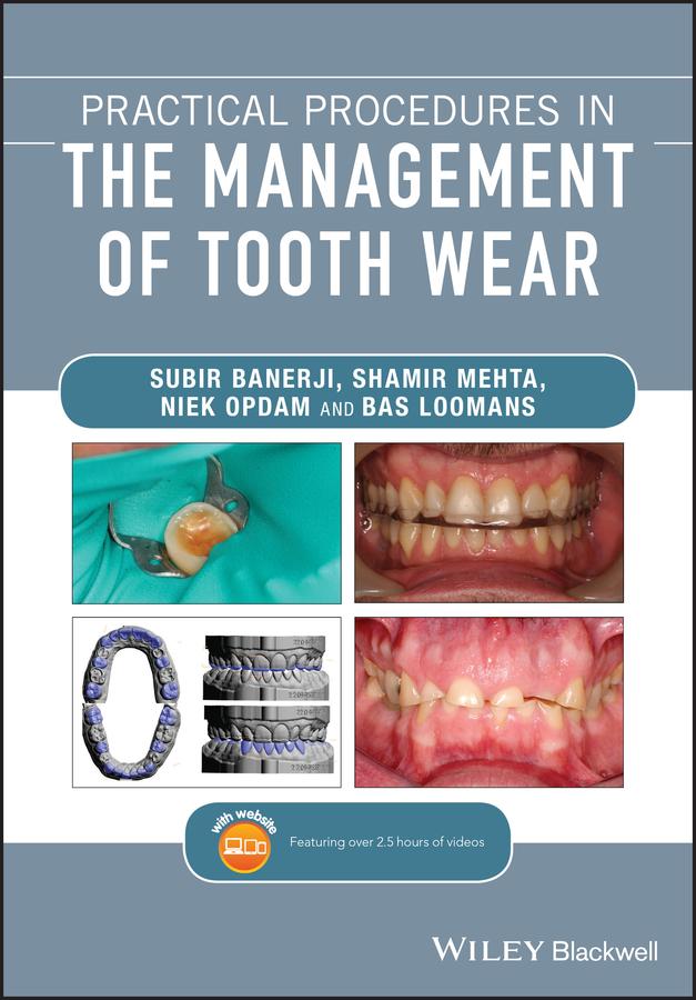 Practical Procedures in the Management of Tooth Wear by Bas Loomans, Niek Opdam, Shamir B. Mehta, Subir Banerji