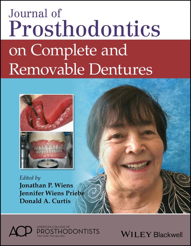 Journal of Prosthodontics on Complete and Removable Dentures by Donald A. Curtis, Jennifer Wiens Priebe, Jonathan P. Wiens