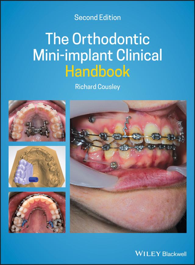 The Orthodontic Mini-implant Clinical Handbook by Richard Cousley