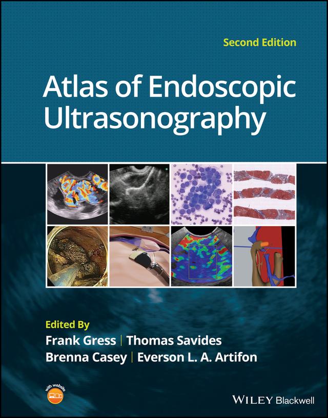 Atlas of Endoscopic Ultrasonography by Brenna Casey, Everson L. A. Artifon, Frank G. Gress, Thomas J. Savides