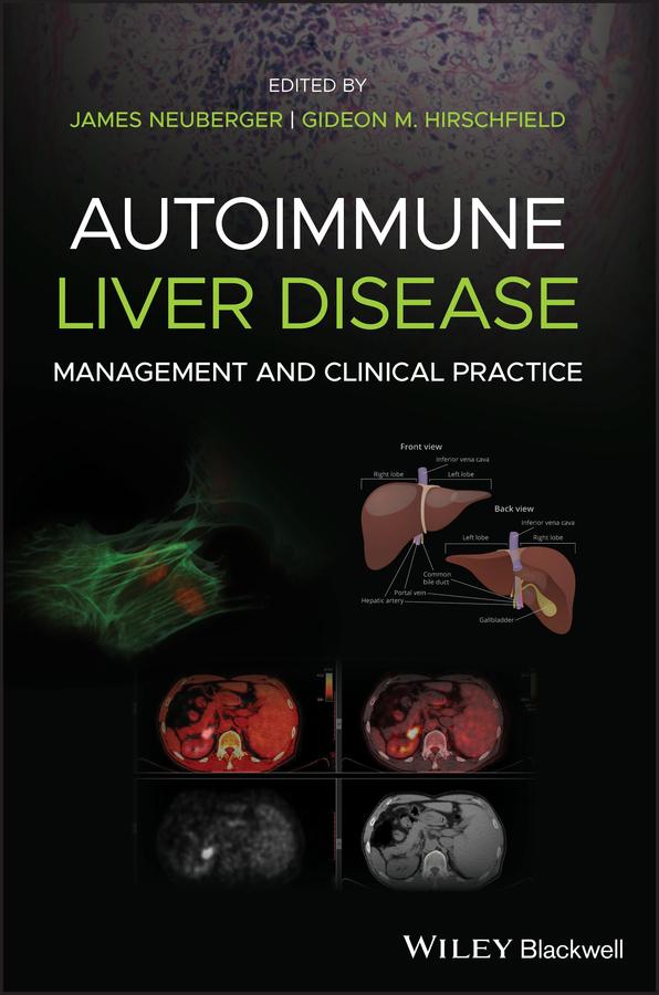 Autoimmune Liver Disease by Gideon M. Hirschfield, James Neuberger