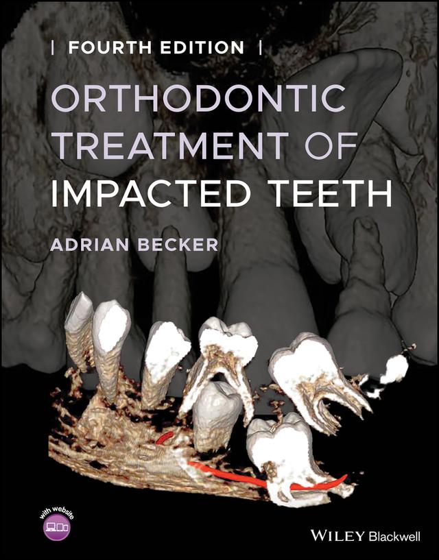 Orthodontic Treatment of Impacted Teeth by Adrian Becker