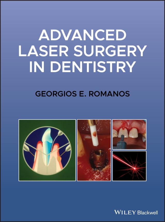 Advanced Laser Surgery in Dentistry by Georgios E. Romanos