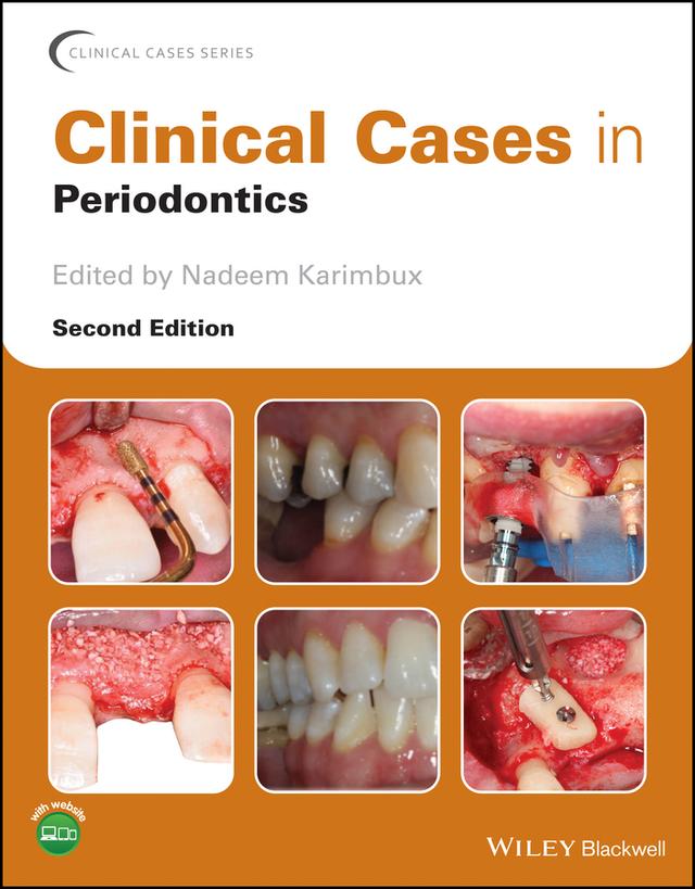 Clinical Cases in Periodontics by Nadeem Karimbux