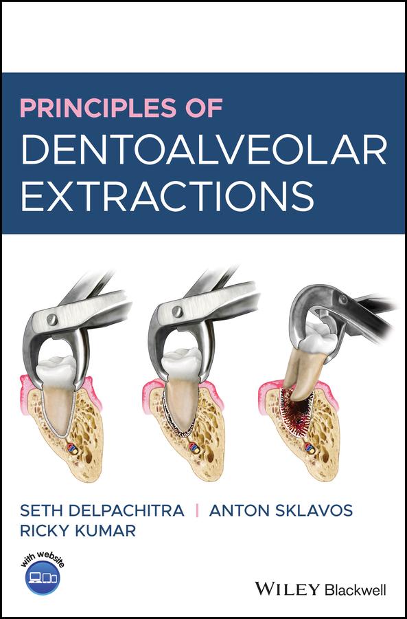 Principles of Dentoalveolar Extractions by Anton Sklavos, Ricky Kumar, Seth Delpachitra