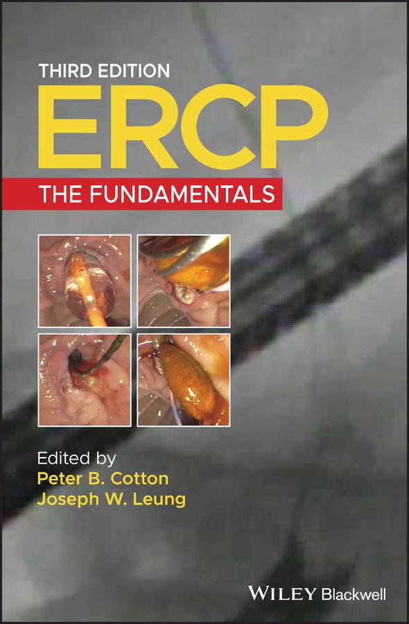 ERCP by Joseph W. Leung, Peter B. Cotton
