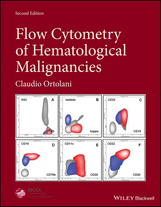 Flow Cytometry of Hematological Malignancies by Claudio Ortolani