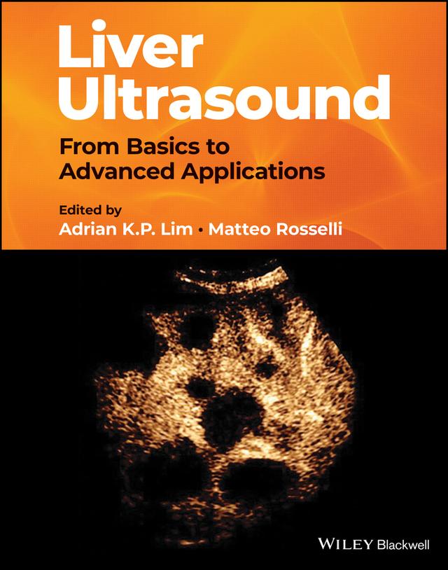 Liver Ultrasound by Adrian K. P. Lim, Matteo Rosselli