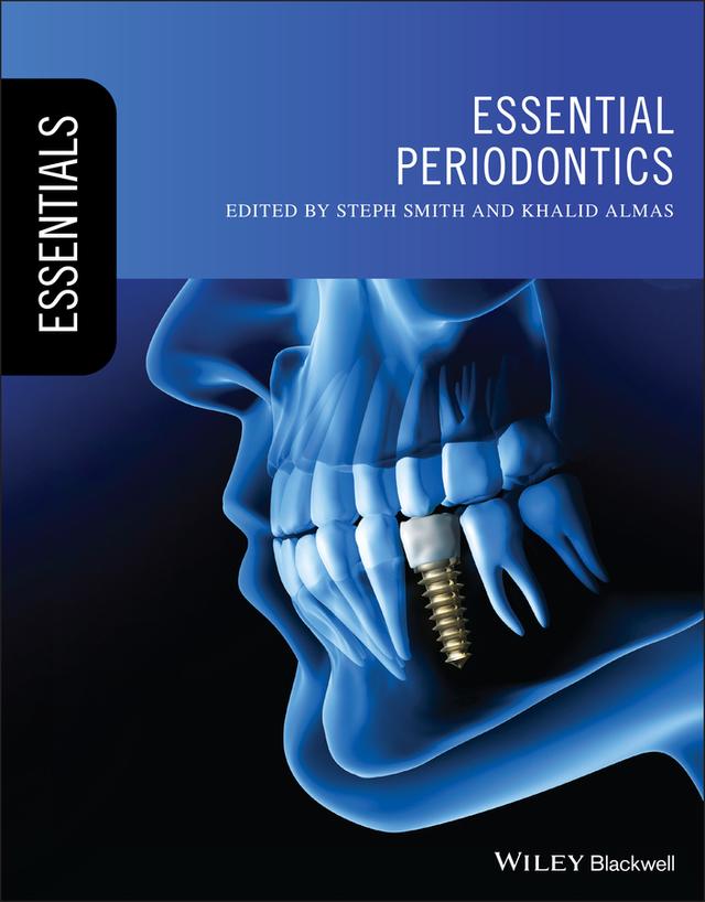 Essential Periodontics by Khalid Almas, Steph Smith