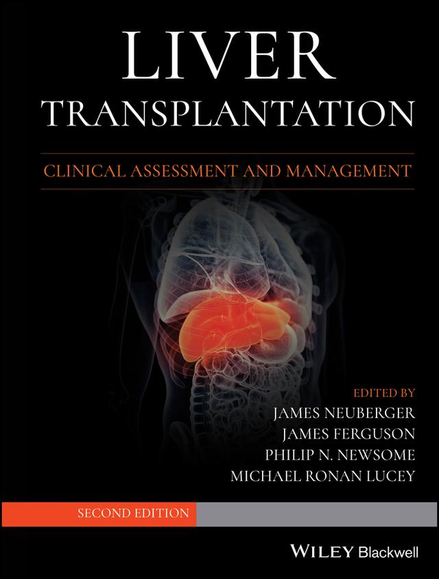 Liver Transplantation by James Ferguson, James Neuberger, Michael R. Lucey, Philip N. Newsome