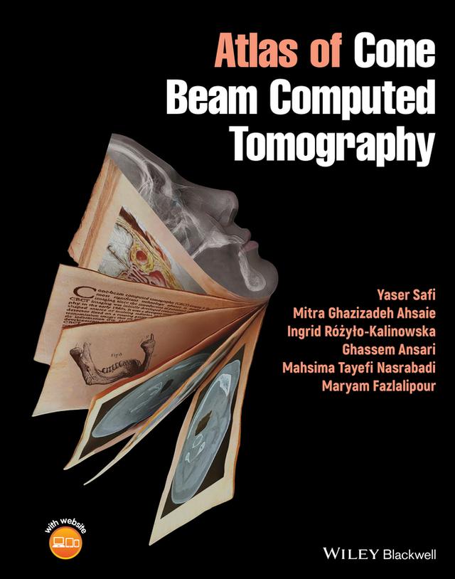 Atlas of Cone Beam Computed Tomography by Ghassem Ansari, Ingrid Różyło-Kalinowska, Mahsima Tayefi Nasrabadi, Maryam Fazlalipour, Mitra Ghazizadeh Ahsaie, Yaser Safi