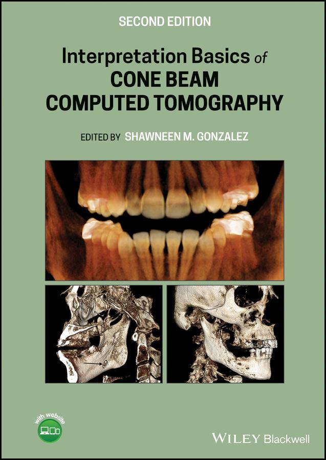 Interpretation Basics of Cone Beam Computed Tomography by Shawneen M. Gonzalez