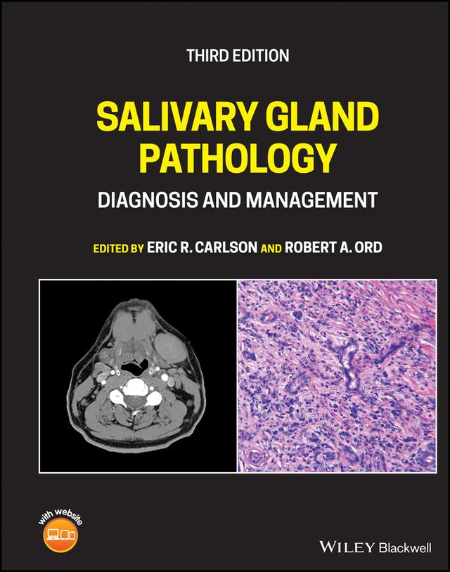 Salivary Gland Pathology by Eric R. Carlson, Robert A. Ord