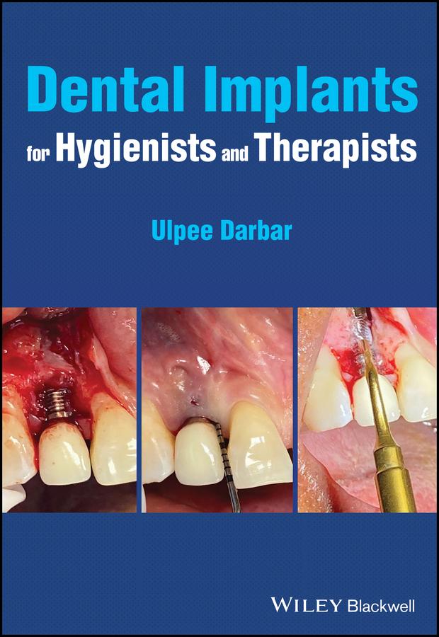 Dental Implants for Hygienists and Therapists by Ulpee R. Darbar