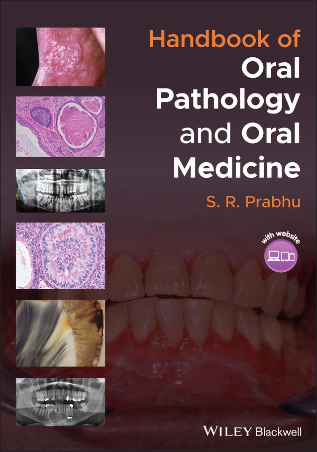 Handbook of Oral Pathology and Oral Medicine by S. R. Prabhu
