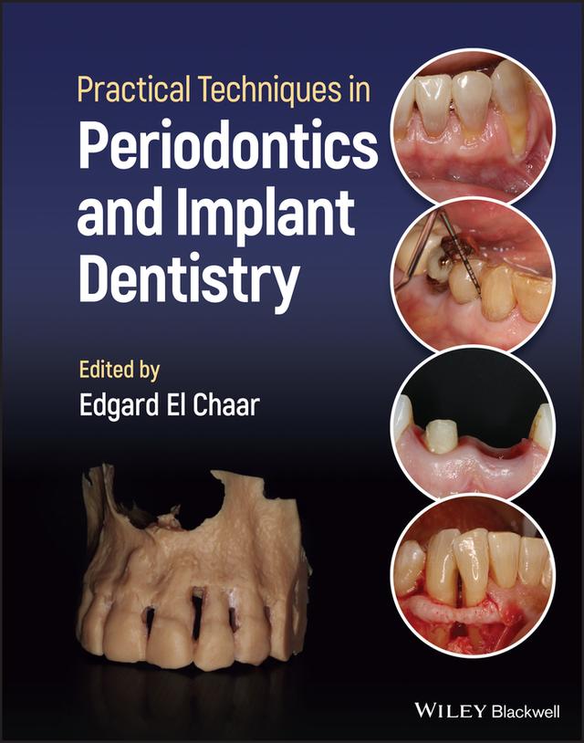 Practical Techniques in Periodontics and Implant Dentistry by Edgard El Chaar