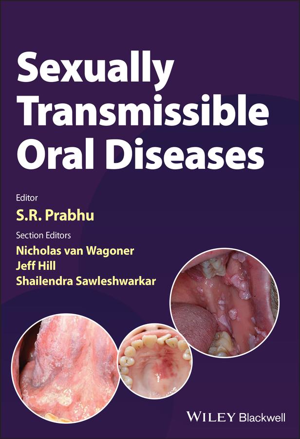 Sexually Transmissible Oral Diseases by Jeff Hill, Nicholas Van Wagoner, Shailendra Sawleshwarkar, S. R. Prabhu