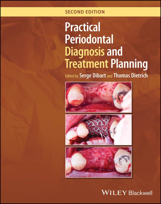 Practical Periodontal Diagnosis and Treatment Planning by Serge Dibart, Thomas Dietrich