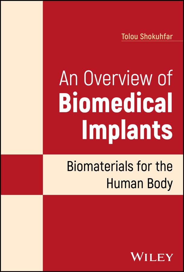 An Overview of Biomedical Implants by Tolou Shokuhfar