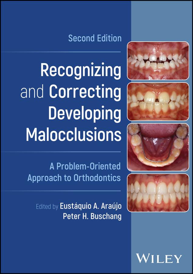 Recognizing and Correcting Developing Malocclusions by Eustáquio A. Araújo, Peter H. Buschang