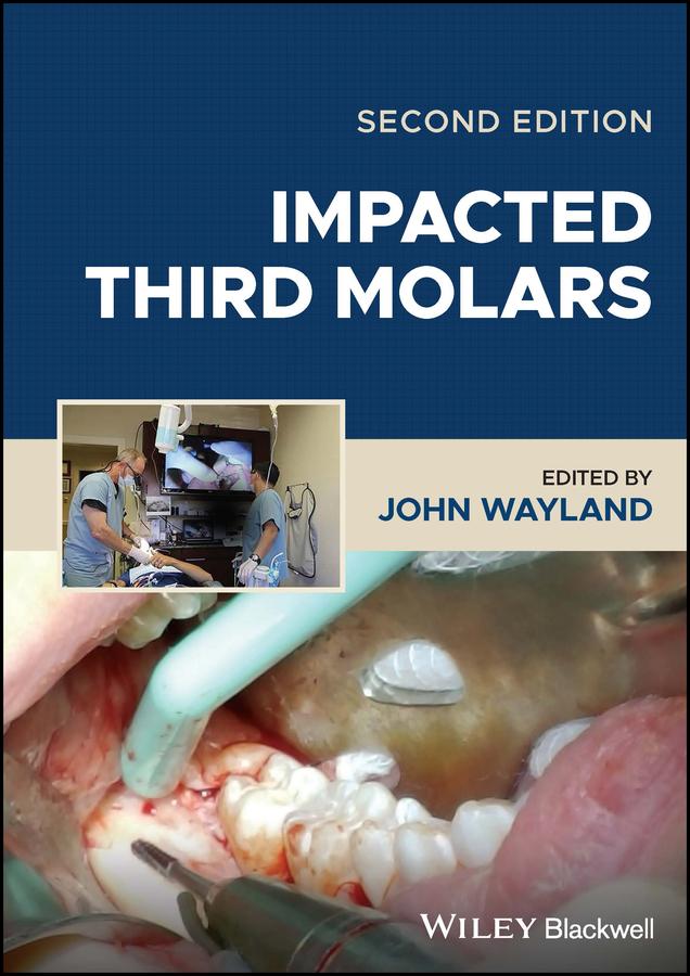 Impacted Third Molars by John Wayland